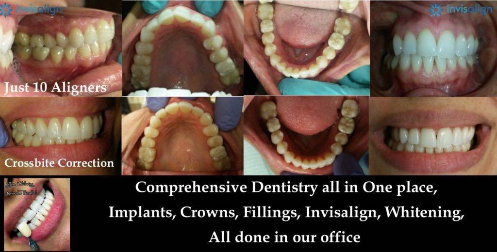 a collage of teeth needing dental care treatments